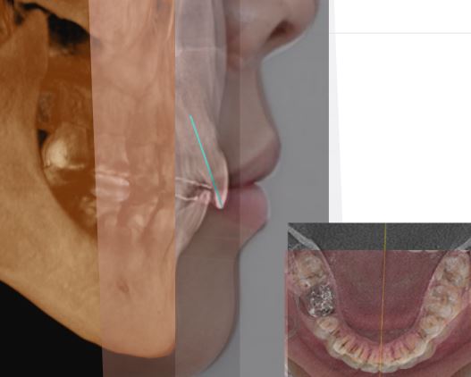 orthodontic diagnostic records